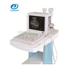 Scanner de ultrassom para gravidez animal e instrumento de ultrassonografia veterinária DW360